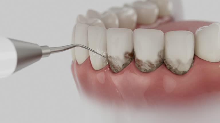 Trusted Wisdom Tooth Removal service in Valley Falls, KS - Dentist Open Now
